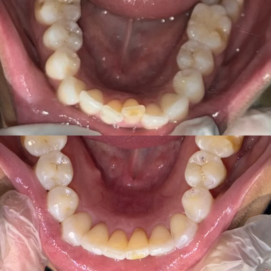 Caso de antes e depois — Odonto 4D